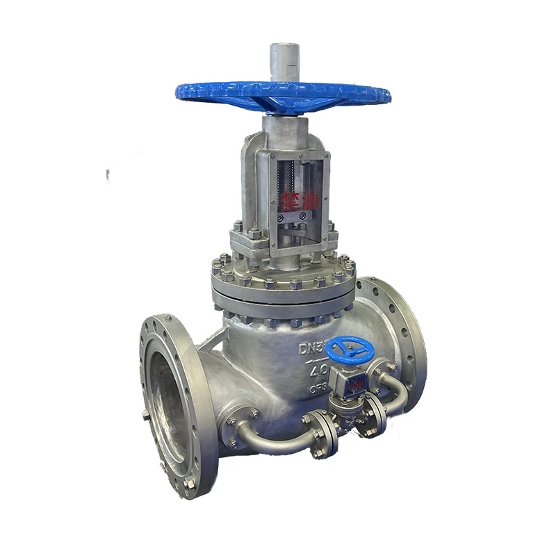 Oxygen Globe Valve high quality Oxygen Globe Valve high quality